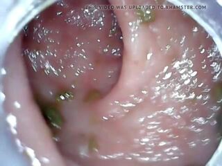 Anaali endoscope osa 1, vapaa peräruiske rankaiseminen hd likainen elokuva 04 | xhamster